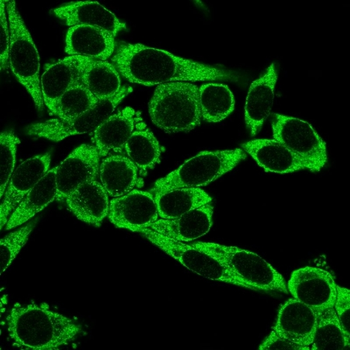 CCR5 Antibody
