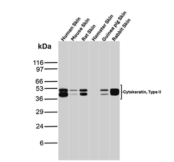 KRT77 Antibody