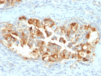 MSLN Antibody