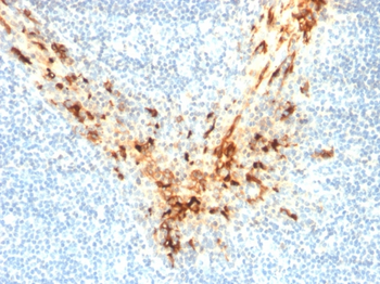 MSLN Antibody