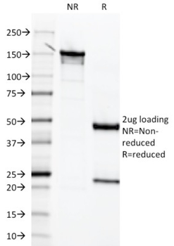 MSLN Antibody
