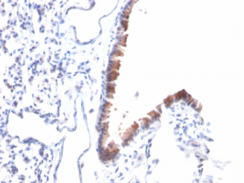MSLN Antibody