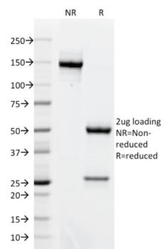 AKT1 Antibody