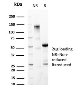 GFAP Antibody