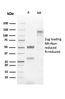 HSPD1 Antibody