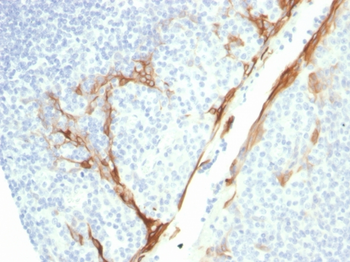 KRT16 Antibody