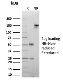 KRT16 Antibody