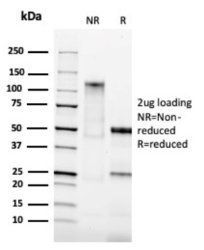 EPCAM Antibody