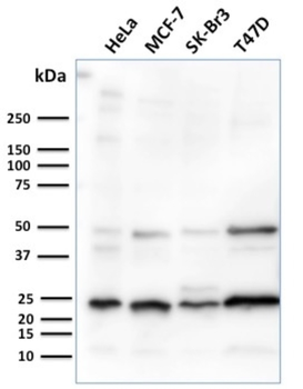 SCGB2A2 Antibody