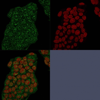 SCGB2A2 Antibody