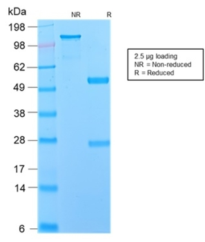 NGFR Antibody