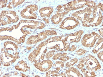 ODC1 Antibody