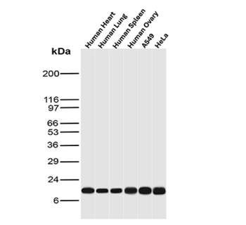 S100A4 Antibody