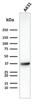 SLC2A1 Antibody
