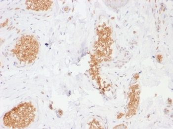 SLC2A1 Antibody