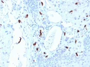 TPSAB1 Antibody