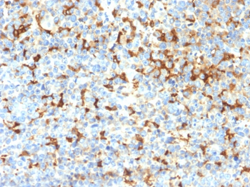 TYRP1 Antibody