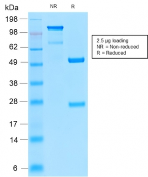 TYRP1 Antibody