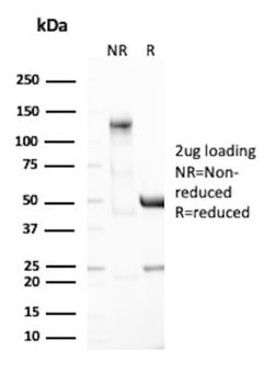 TYRP1 Antibody