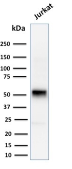 CCNE1 Antibody