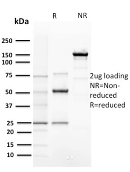 CCNE1 Antibody