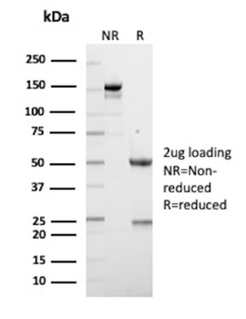 CCNE1 Antibody