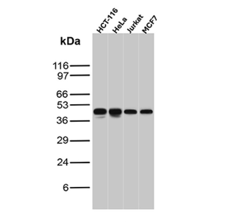 CCNE1 Antibody