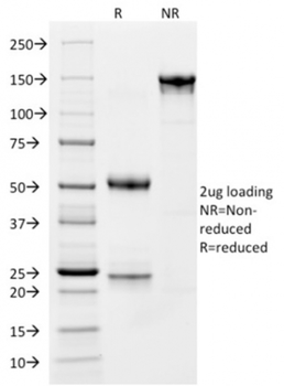 TPSAB1 Antibody