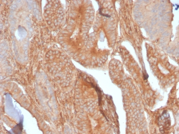 CD81 Antibody