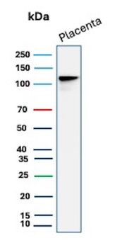 CDH1 Antibody