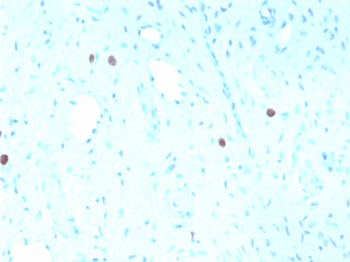 Recombinant HPV-16 (Human Papilloma Virus 16) Antibody
