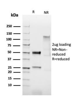 Recombinant HPV-16 (Human Papilloma Virus 16) Antibody