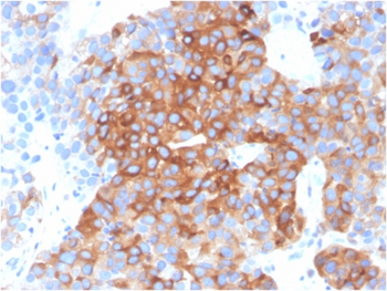 TUBB3 Antibody