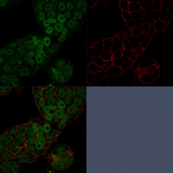 CHD4 Antibody