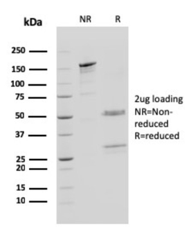 CTSD Antibody
