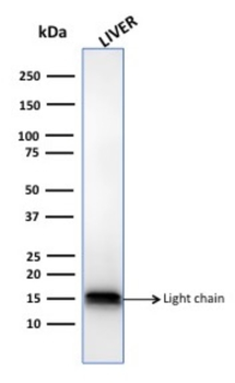 CTSD Antibody