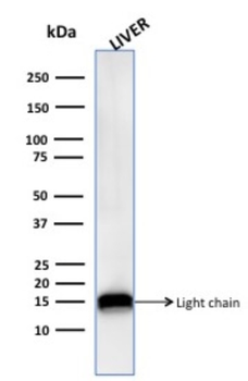CTSD Antibody
