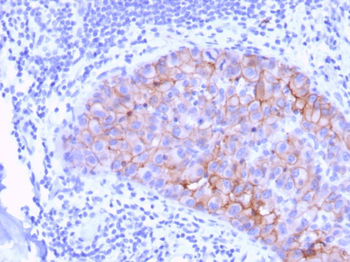 ERBB2 Antibody