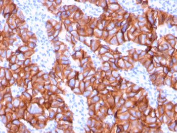 ERBB2 Antibody