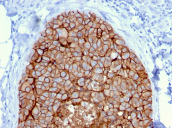 ERBB2 Antibody