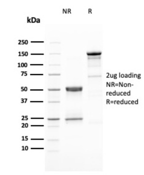 ERBB2 Antibody