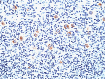 FUT4 Antibody