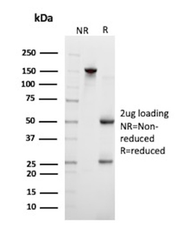 KLK3 Antibody
