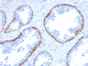 KRT5 Antibody