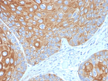 KRT5 Antibody