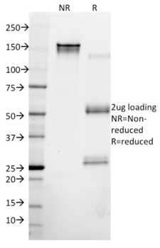 KRT8 Antibody