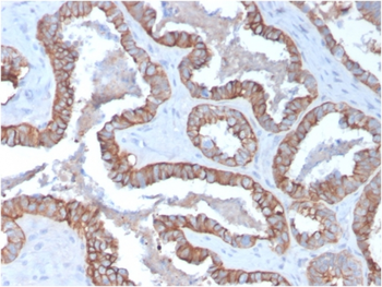 KRT15 Antibody