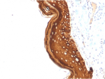 KRT15 Antibody