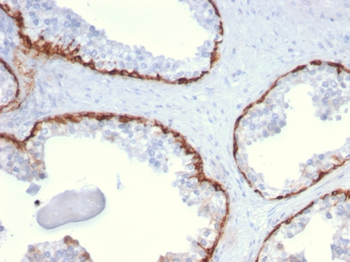 KRT15 Antibody