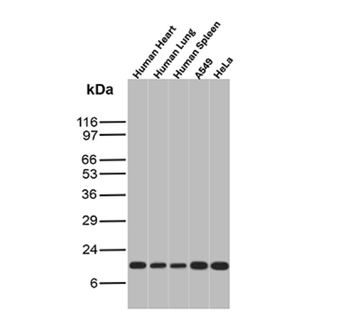 S100A4 Antibody